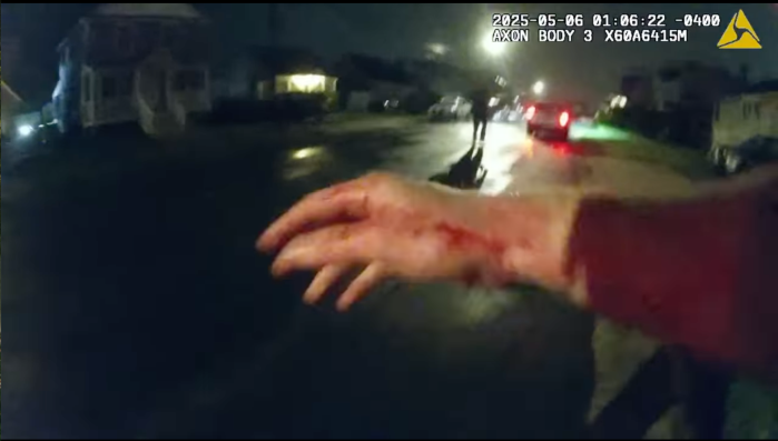 After he was allegedly stabbed, the police officer's hand appeared bloody in his body cam footage.